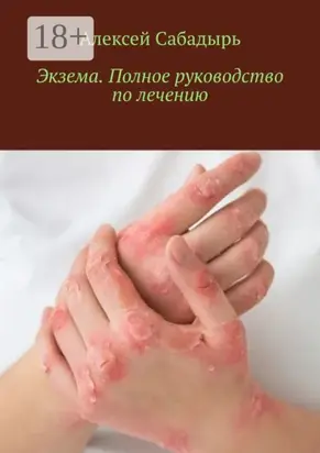 Экзема. Полное руководство по лечению