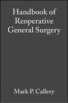 Handbook of Reoperative General Surgery