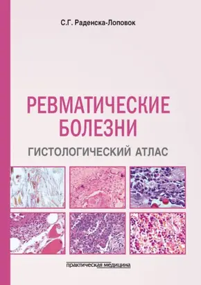 Ревматические болезни. Гистологический атлас