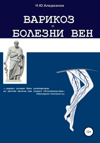 Варикоз и болезни вен