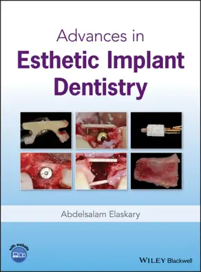Advances in Esthetic Implant Dentistry