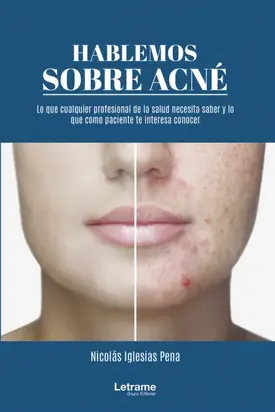 Hablemos sobre acné: 01 (Manual)