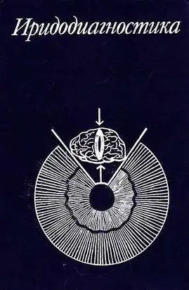 Иридодиагностика