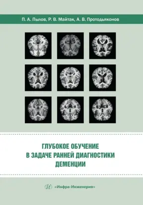 Глубокое обучение в задаче ранней диагностики деменции