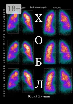 ХОБЛ. Хроническая обструктивная болезнь лёгких