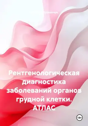 Рентгенологическая диагностика заболеваний органов грудной клетки. АТЛАС