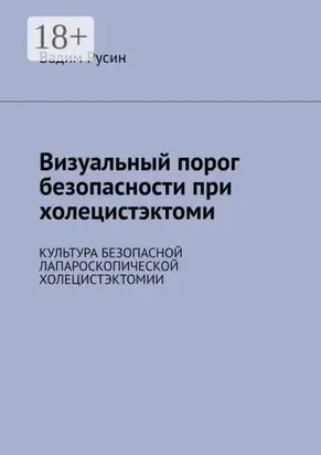 Визуальный порог безопасности при холецистэктоми. Культура безопасной лапароскопической холецистэктомии