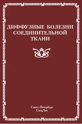 Диффузные болезни соединительной ткани