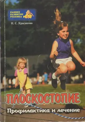 Плоскостопие у детей