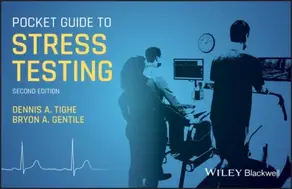 Pocket Guide to Stress Testing