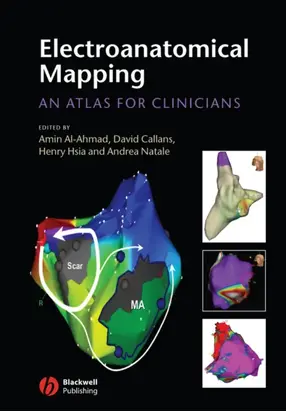 Electroanatomical Mapping