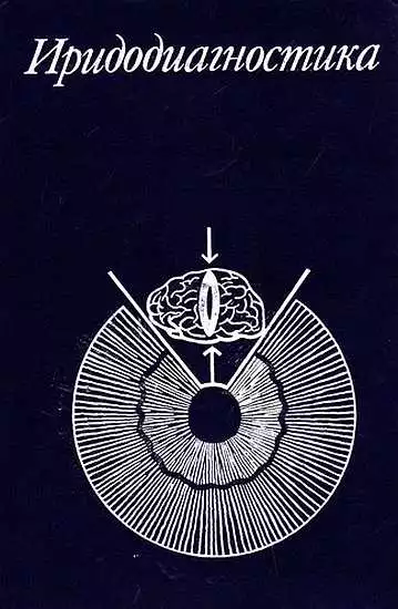 Иридодиагностика