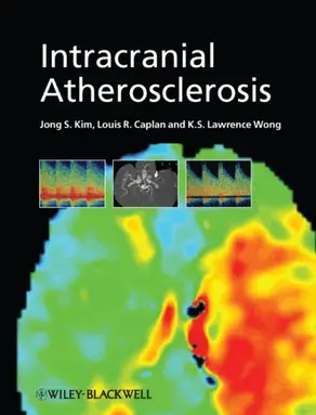Intracranial Atherosclerosis