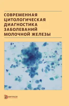 Современная цитологическая диагностика заболеваний молочной железы
