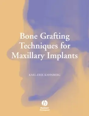 Bone Grafting Techniques for Maxillary Implants