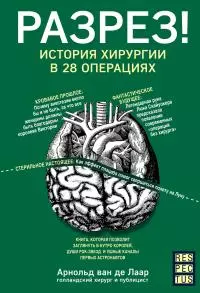 Разрез! История хирургии в 28 операциях