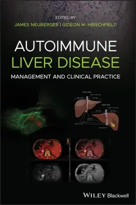 Autoimmune Liver Disease