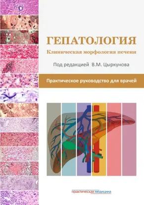 Гепатология. Клиническая морфология печени. Практическое руководство для врачей