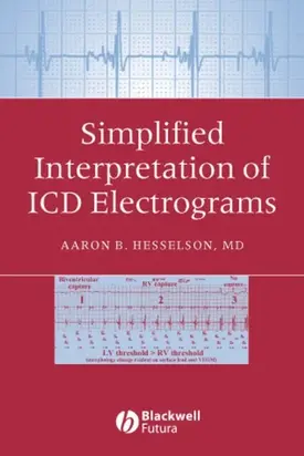 Simplified Interpretation of ICD Electrograms
