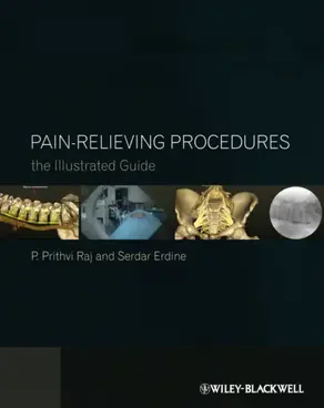 Pain-Relieving Procedures. The Illustrated Guide